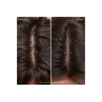 Biolage ScalpSync Universal Conditioner 280mL