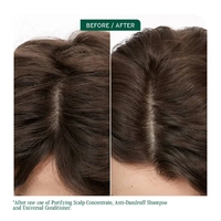 Biolage Scalp Sync Anti-Dandruff Shampoo 400mL