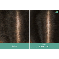 Biolage ScalpSync Anti-Dandruff Shampoo 400mL